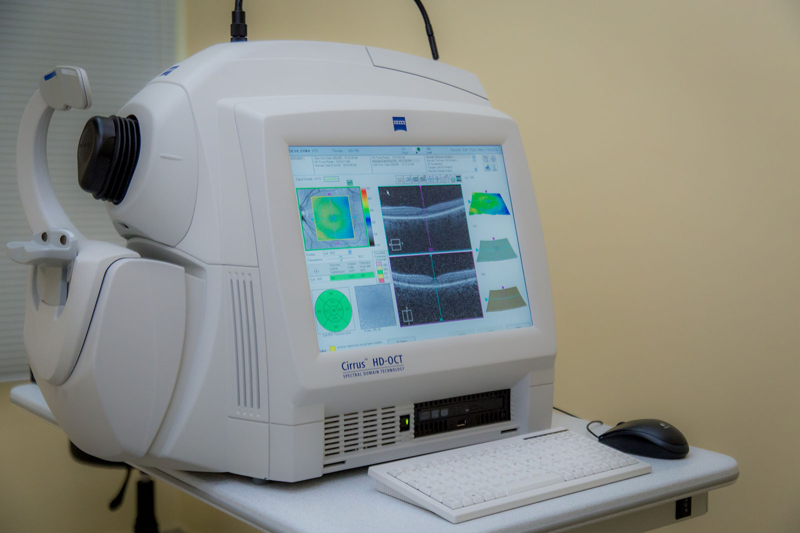No Dia Internacional do Diabético, conheça os avanços no diagnóstico de doenças oculares